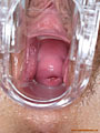 132